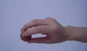 兒童發育遲緩康復訓練——小兒腦癱的作業療法訓練